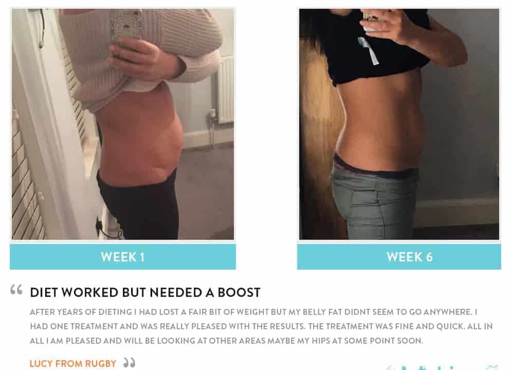 Before and After Dieting Chester