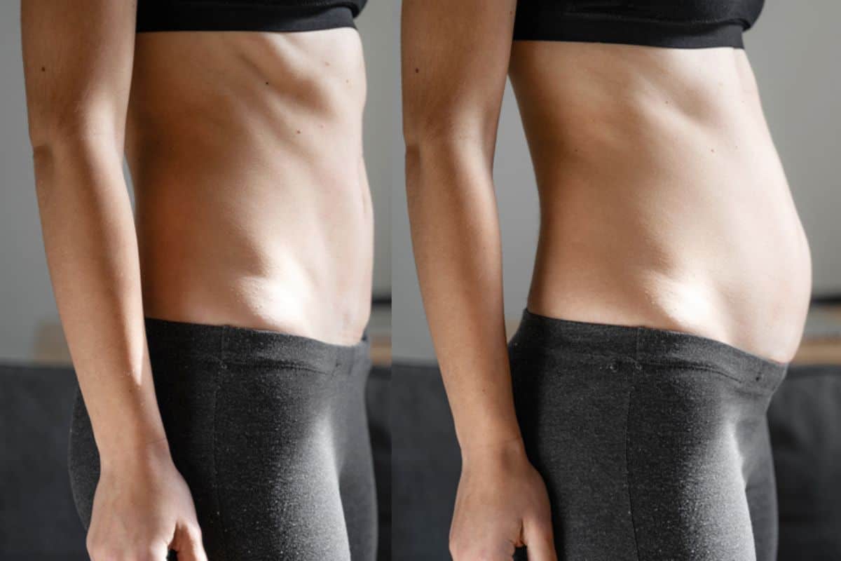 How long does diastasis recti take to improve Chester?