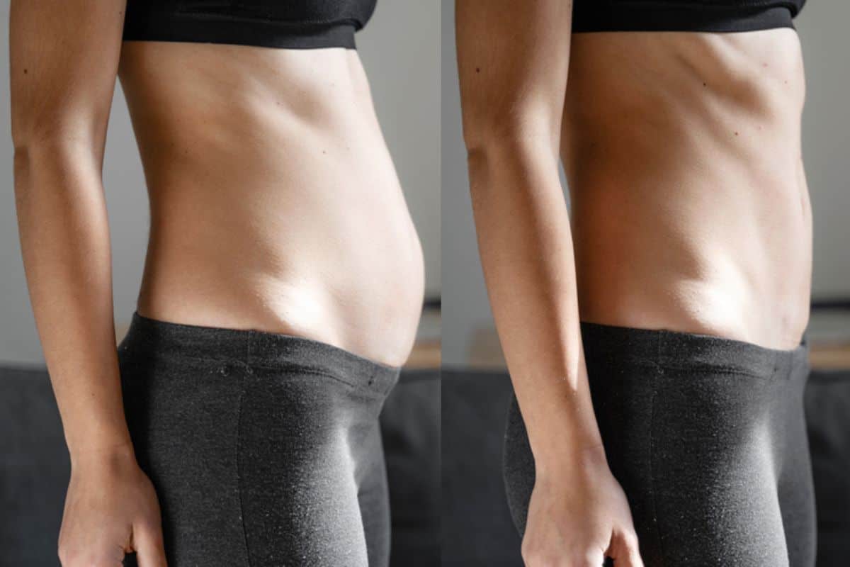 Post-Pregnancy: What Happens to Your Abdominal Muscles After Birth Chester