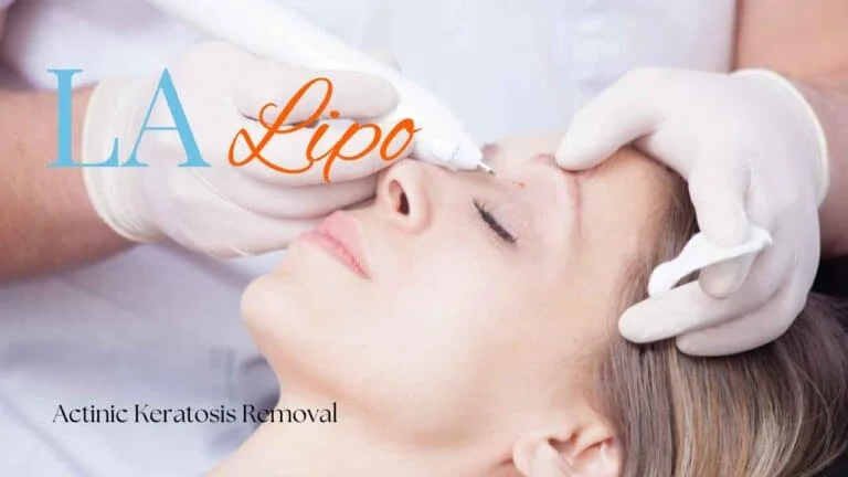 Woman receiving Actinic Keratosis Removal Treatment Chester