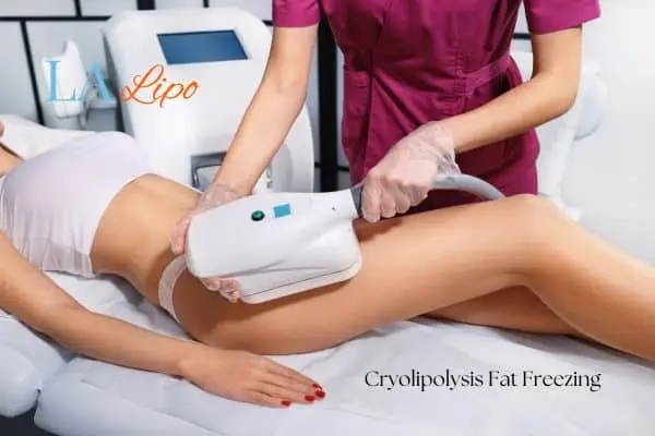 Woman receiving coolsculpting Chester treatment on her thighs