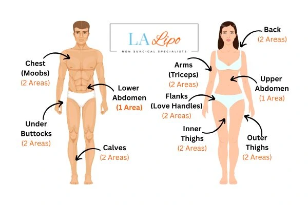 LA LIPO Cryolipolysis Areas Chester