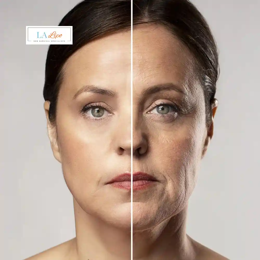 How Can You Tell If Non-Surgical Skin Tightening Is Right for You Chester?