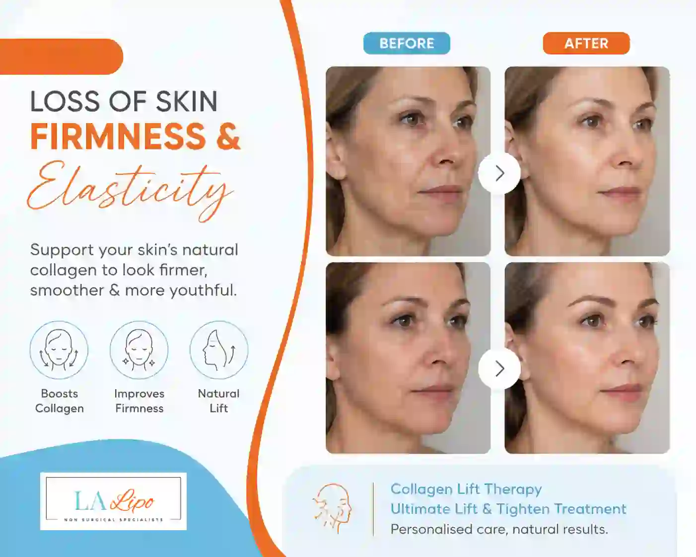 Sign #7: Loss of Skin Firmness and Elasticity Chester
